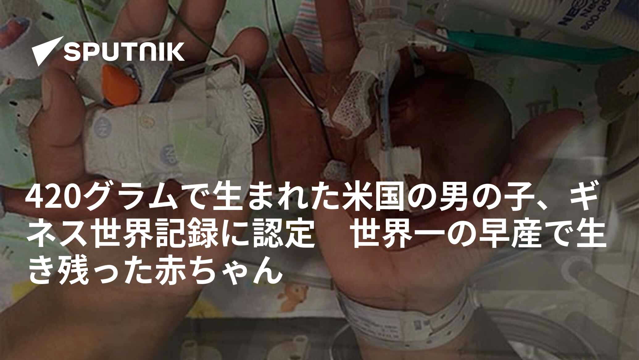 420グラムで生まれた米国の男の子、ギネス世界記録に認定 世界一の早産