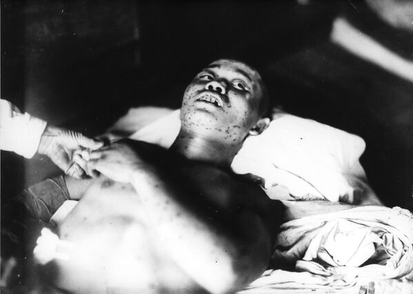 1945年9月3日、広島第1陸軍病院宇品分院の簡易ベッドの上に横たわる兵士 - Sputnik 日本