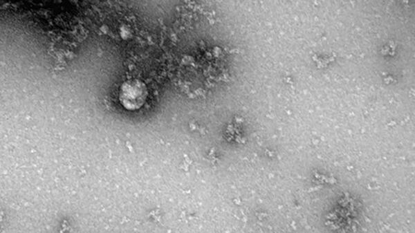 Снимок британского штамма нового коронавируса - Sputnik 日本