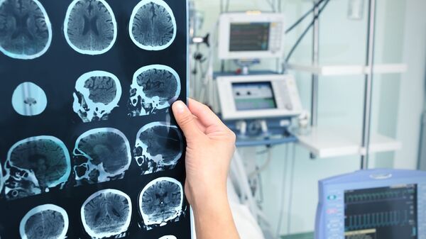 MRI脳画像 - Sputnik 日本