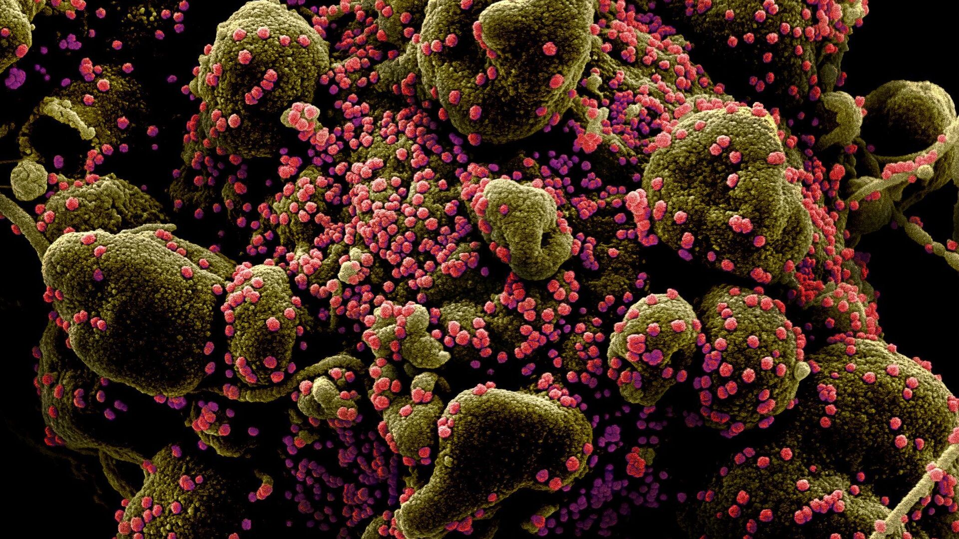 Вид на зараженную коронавирусом клетку под микроскопом - Sputnik 日本, 1920, 29.04.2021