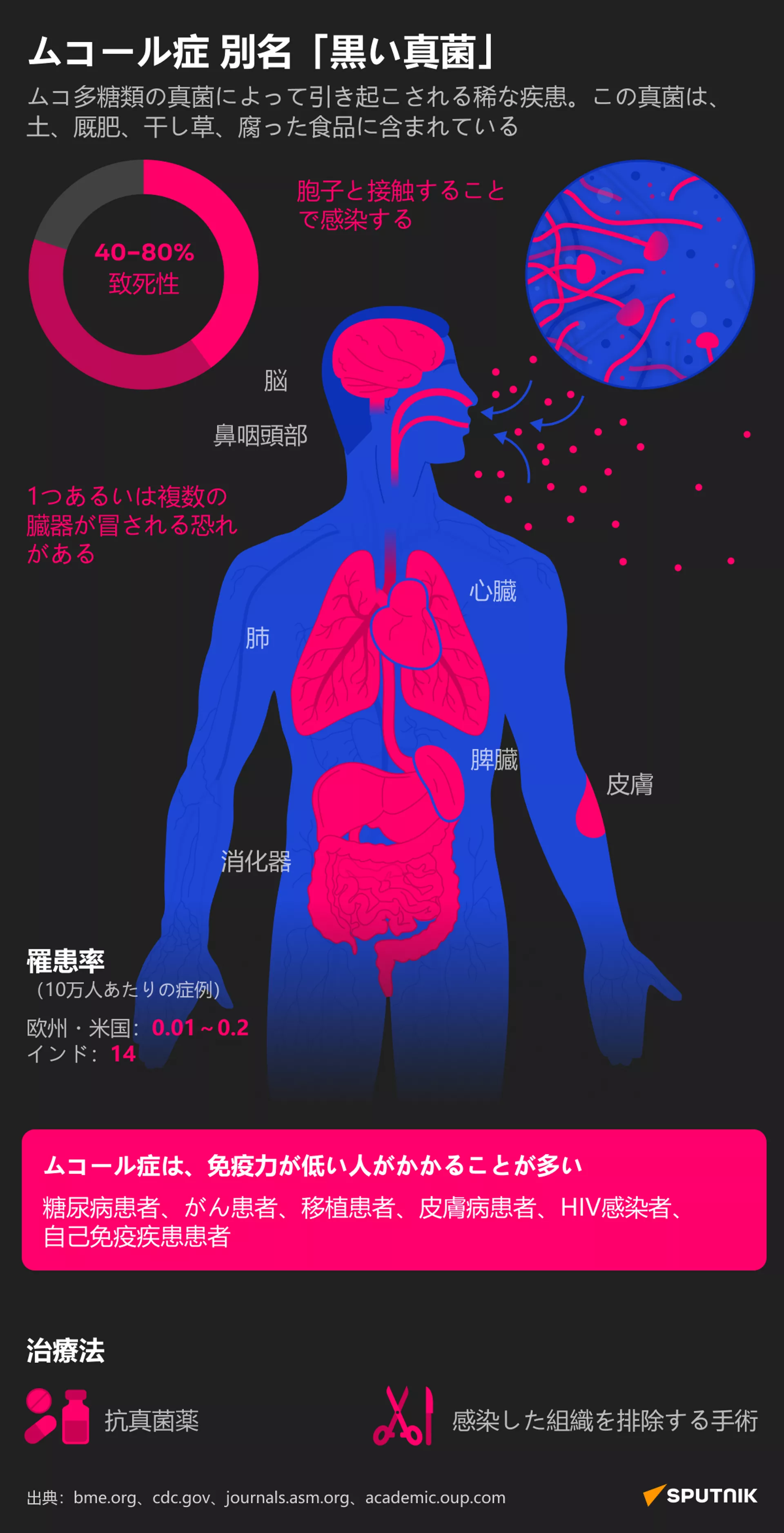 インドで「黒カビ病」拡大 コロナ完治患者の骨組織が壊疽するケースが増加 インドで「黒カビ病」拡大 コロナ完治患者の骨組織が壊疽するケースが増加 - Sputnik 日本, 1920, 05.07.2021