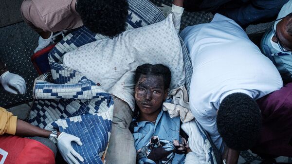 Раненая жительница деревни Тогоги в Эфиопии, пострадавшая от авиаудара - Sputnik 日本