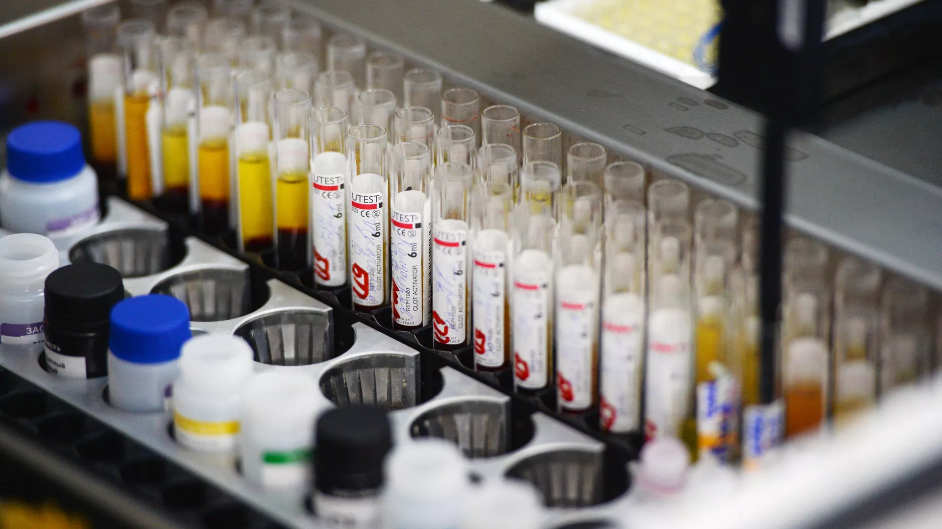 血液感染症（肝炎、梅毒、HIV）の検査が行われている酵素免疫測定法（EIA）研究室