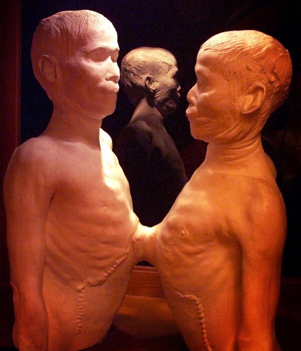 医学博物館「ムター美術館」。タイの結合双生児チャン＆エン・ブンカー兄弟の石膏模型やアインシュタインの脳などが展示されている（米ペンシルベニア州・フィラデルフィア） - Sputnik 日本