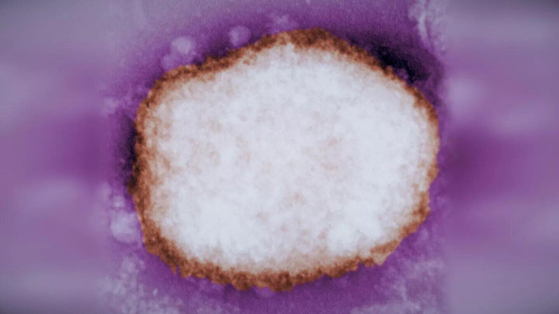 電子顕微鏡で見たサルポックスウイルス - Sputnik 日本, 1920, 25.05.2022