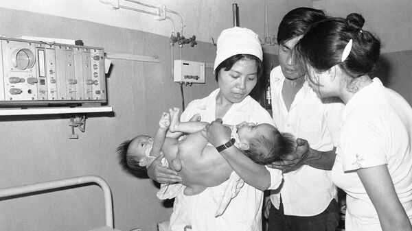 病院治療を受ける結合双生児（ベトナム・ハノイ、1982年5月30日） - Sputnik 日本
