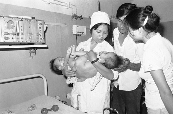 病院治療を受ける結合双生児（ベトナム・ハノイ、1982年5月30日） - Sputnik 日本