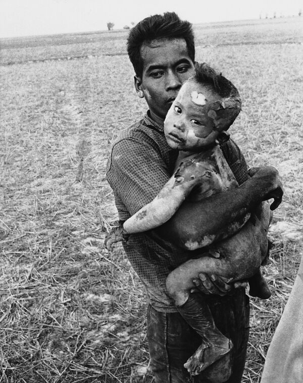 ナパーム弾によって全身火傷を負った子どもを抱く父親、カンボジアとの国境に近いベトナムの村で、1964年3月19日撮影 - Sputnik 日本