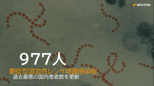 レンサ球菌感染症 - Sputnik 日本