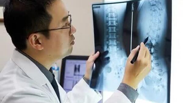 【日本人研究者 高齢者の脊椎骨折の新治療法を開発】 - Sputnik 日本