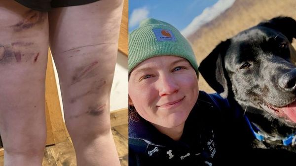 【クマの襲撃、女性が柔術で撃退 アラスカ】 愛犬「ヴェスパー」の散歩に出かけたケイトリン・レーンさんは、サケ科の魚が生息する川の近くで、クマの親子に遭遇した。体重およそ800キロの母グマと子グマたちが茂みから飛び出し、ケイトリンさんたちの方に向かってきた。 - Sputnik 日本