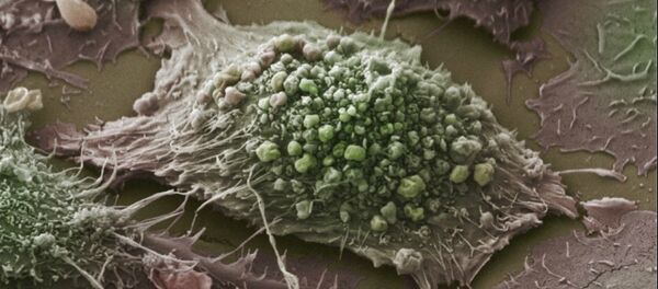 ガン細胞に変化する寄生虫が発見 ガン細胞に変化する寄生虫が発見 - Sputnik 日本