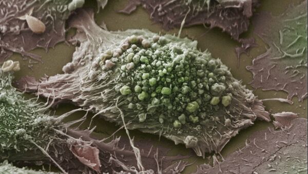 ガン細胞に変化する寄生虫が発見 - Sputnik 日本