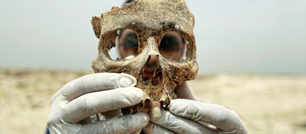 原始人の歯から最も古い肝炎ウイルスが見つかる - Sputnik 日本