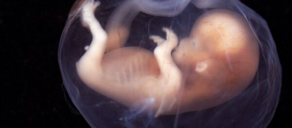 胎児 胎児 - Sputnik 日本