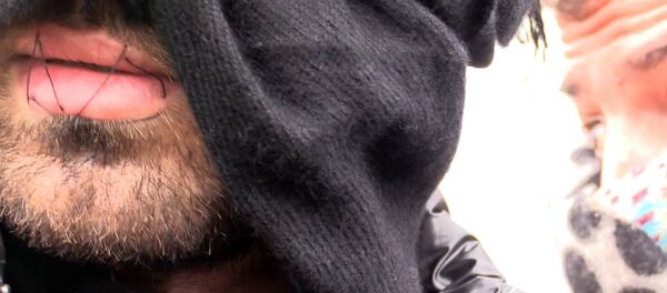 イラン人難民、カレーの難民キャンプ撤去に抗議して口を縫い付ける イラン人難民、カレーの難民キャンプ撤去に抗議して口を縫い付ける - Sputnik 日本