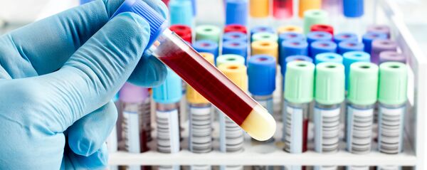 血液 血液 - Sputnik 日本