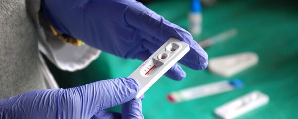 中国でHIVを抑える薬剤開発に成功 中国でHIVを抑える薬剤開発に成功 - Sputnik 日本