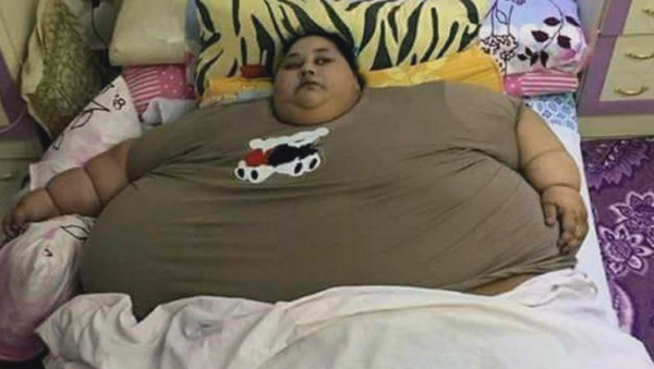 世界最重量の女性がインドの病院で１４０キロ減量 - Sputnik 日本