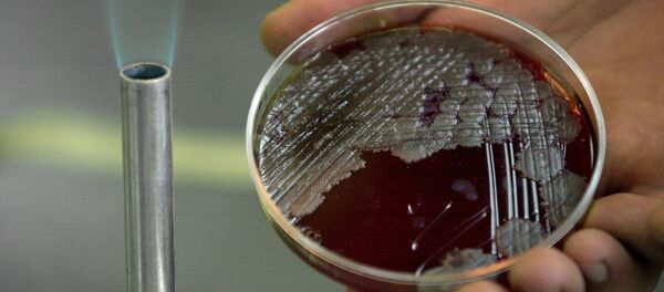 炭疽菌のサンプル 炭疽菌のサンプル - Sputnik 日本