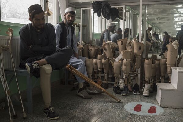 アフガニスタン、カブールの整形外科クリニック - Sputnik 日本