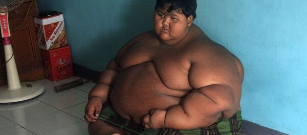 世界一の肥満児 世界一の肥満児 - Sputnik 日本