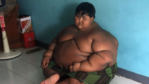 世界一の肥満児