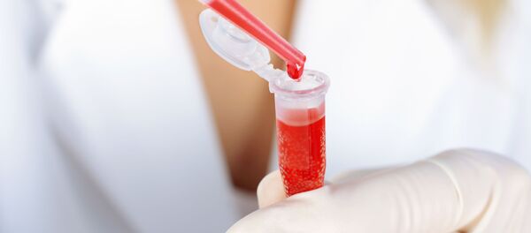 新型コロナの感染リスクには血液型が関係している=中国の研究者 新型コロナの感染リスクには血液型が関係している=中国の研究者 - Sputnik 日本