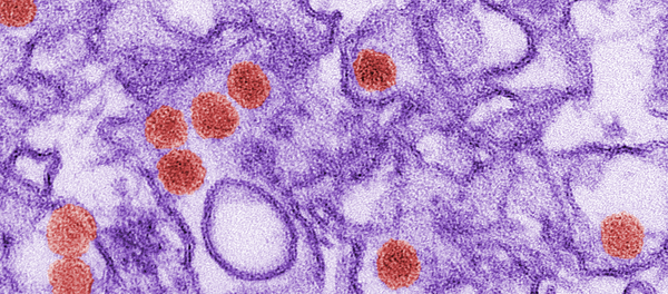 Virus Zika - Sputnik 日本