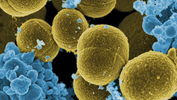 Bacteria