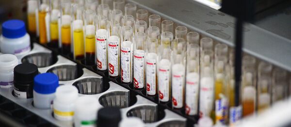 中国で、HIV抗体が含まれている可能性のある免疫グロブリン製剤に関する調査が行われる - Sputnik 日本