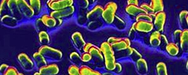 Вызывающая чуму бактерия Yersinia pestis Вызывающая чуму бактерия Yersinia pestis - Sputnik 日本