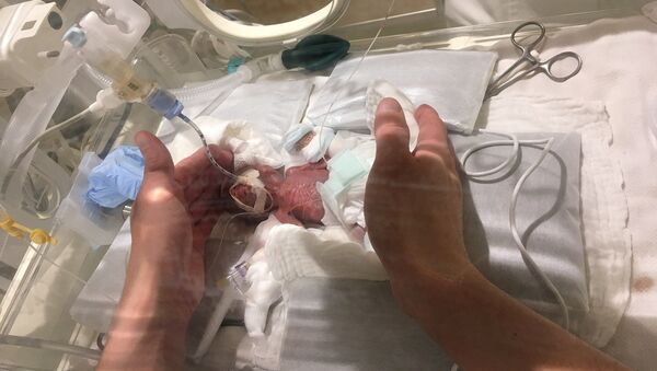 ２６８グラムで誕生の赤ちゃんが退院　世界最小 - Sputnik 日本
