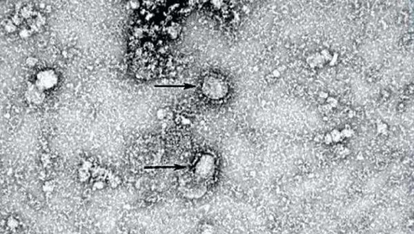 中国科学者に撮られた新型コロナウイルス画像 - Sputnik 日本