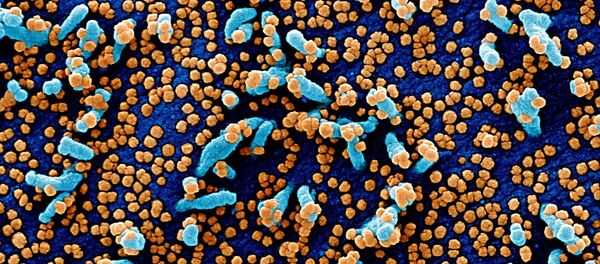 コロナウイルスに囲まれた人間細胞 コロナウイルスに囲まれた人間細胞 - Sputnik 日本