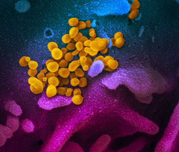 培養細胞（青/ピンク）の表面から出現した、患者から分離された新型コロナウイルスSARS-CoV-2（黄） - Sputnik 日本