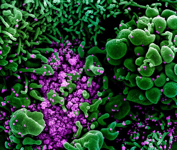 新型コロナウイルスSARS-CoV-2（紫）に重度に感染したアポトーシス細胞（緑） - Sputnik 日本