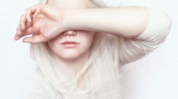 Девушка-альбинос закрывает глаза рукой - Sputnik 日本