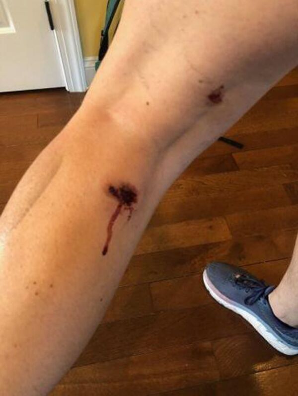 米警察　スプートニク社プロデューサーに向けて発砲　弾は数発 - Sputnik 日本