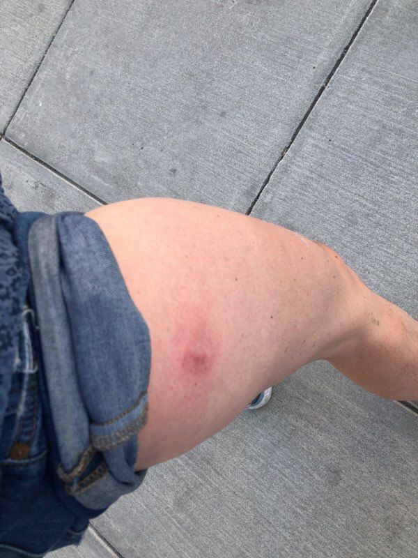 米警察　スプートニク社プロデューサーに向けて発砲　弾は数発 - Sputnik 日本