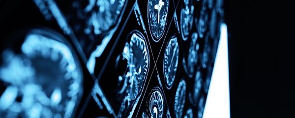 脳のMRI 脳のMRI - Sputnik 日本