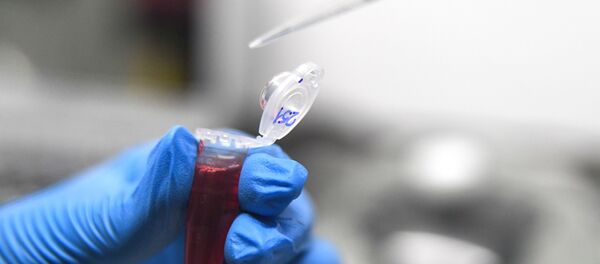 シベリア連邦大学 血液試料 - Sputnik 日本