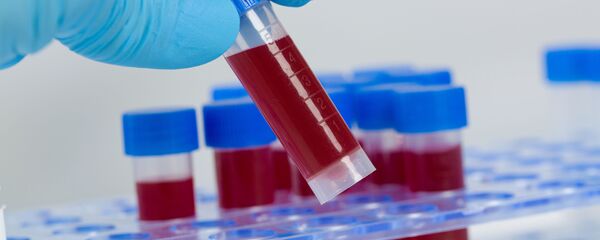 血液 血液 - Sputnik 日本