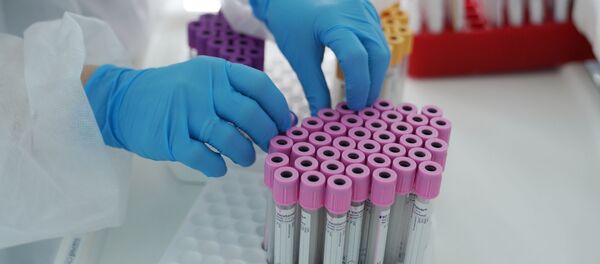 抗体検査キット 抗体検査キット - Sputnik 日本